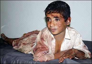 Iraq War Children